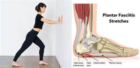 ayurvedic treatment for plantar fasciitis|plantar fasciitis exercises.